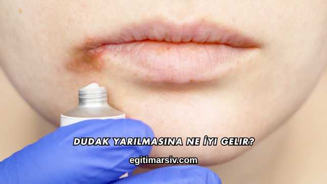 Dudak Yarılmasına Ne İyi Gelir?