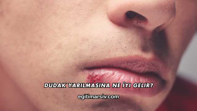 Dudak Yarılmasına Ne İyi Gelir?