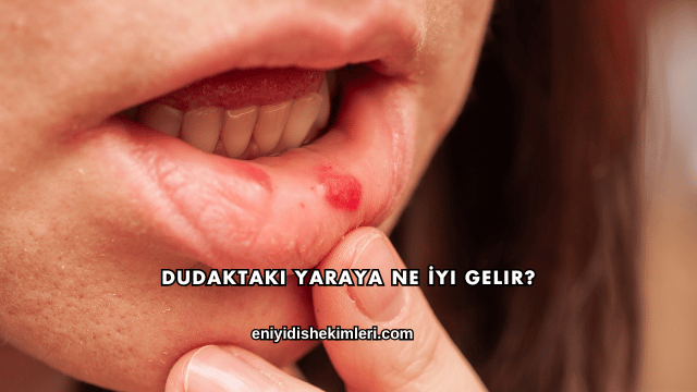 Dudaktaki Yaraya Ne İyi Gelir?