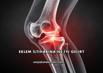 Eklem İltihabına Ne İyi Gelir?