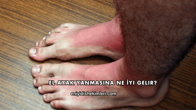 El Ayak Yanmasına Ne İyi Gelir?