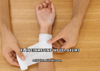 El İncınmesine Ne İyi Gelir?