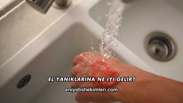 El Yanıklarına Ne İyi Gelir?