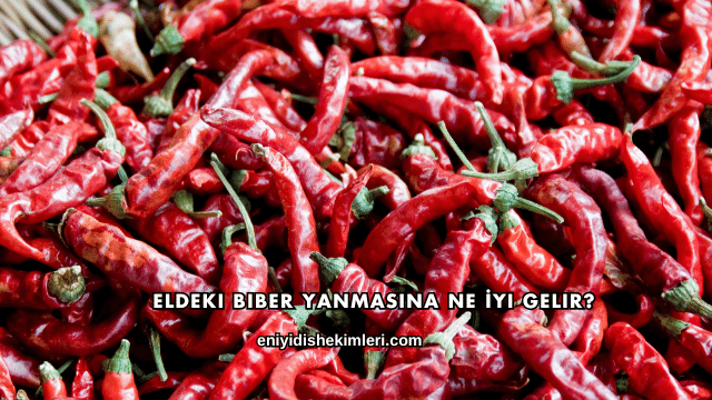 Eldeki Biber Yanmasına Ne İyi Gelir?