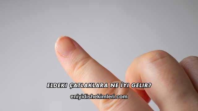 Eldeki Çatlaklara Ne İyi Gelir?