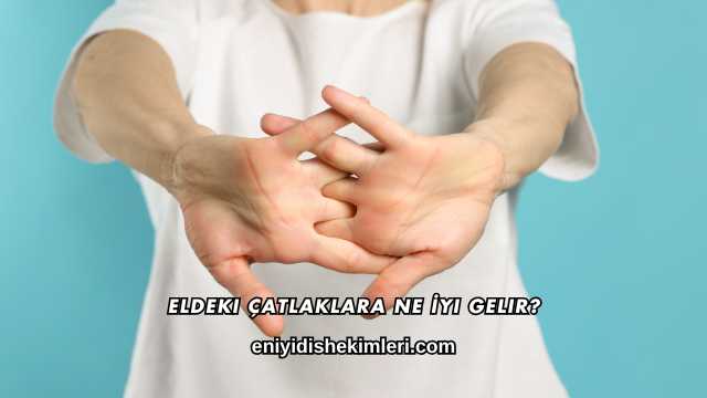 Eldeki Çatlaklara Ne İyi Gelir?