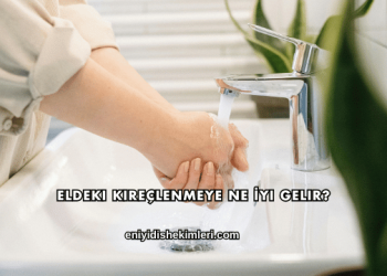 Eldeki Kireçlenmeye Ne İyi Gelir?