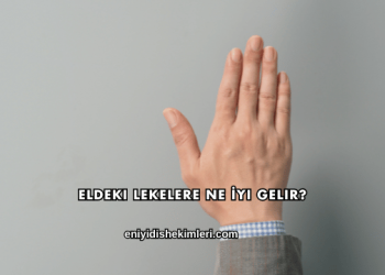 Eldeki Lekelere Ne İyi Gelir?