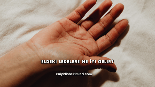 Eldeki Lekelere Ne İyi Gelir?
