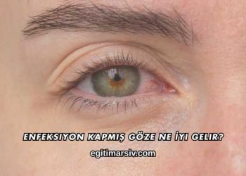 Enfeksiyon Kapmış Göze Ne İyi Gelir?