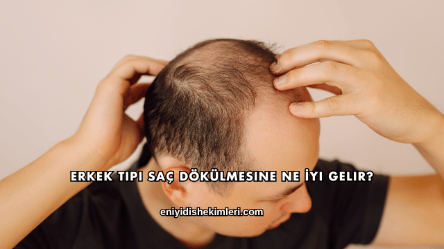 Erkek Tipi Saç Dökülmesine Ne İyi Gelir?