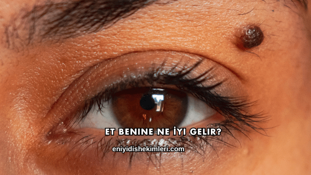Et Benine Ne İyi Gelir?