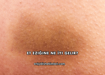 Et Eziğine Ne İyi Gelir?