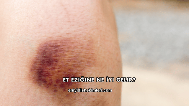 Et Eziğine Ne İyi Gelir?