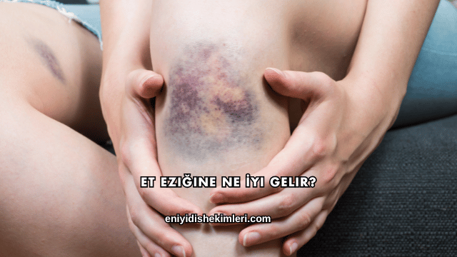 Et Eziğine Ne İyi Gelir?