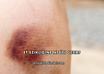 Et Ezikliğine Ne İyi Gelir?