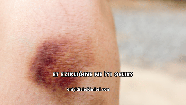 Et Ezikliğine Ne İyi Gelir?