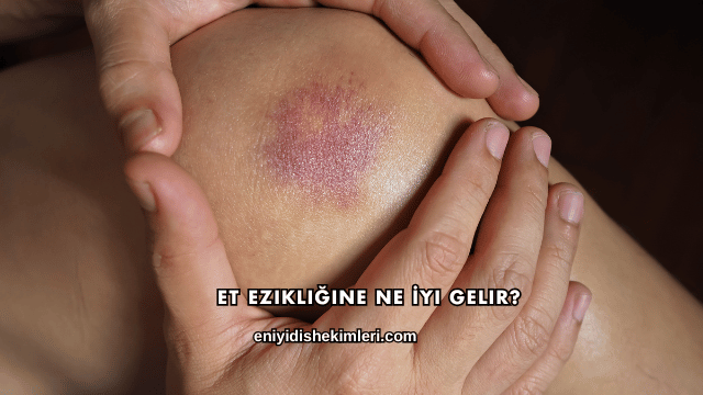 Et Ezikliğine Ne İyi Gelir?