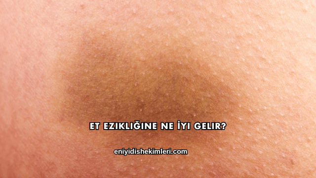 Et Ezikliğine Ne İyi Gelir?