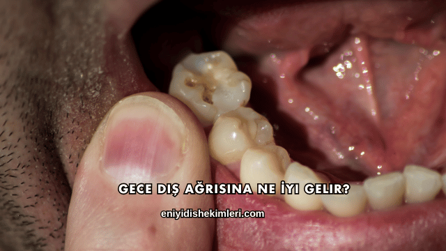 Gece Diş Ağrısına Ne İyi Gelir?