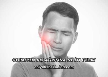 Geçmeyen Diş Ağrısına Ne İyi Gelir?