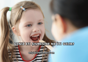 Geniz Eti Şişmesine Ne İyi Gelir?