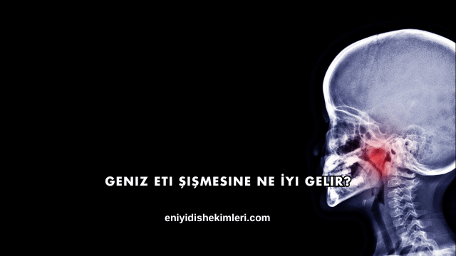 Geniz Eti Şişmesine Ne İyi Gelir?