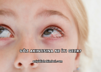 Göz Akıntısına Ne İyi Gelir?