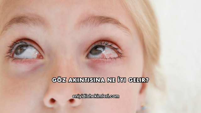 Göz Akıntısına Ne İyi Gelir?