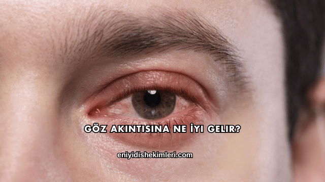 Göz Akıntısına Ne İyi Gelir?