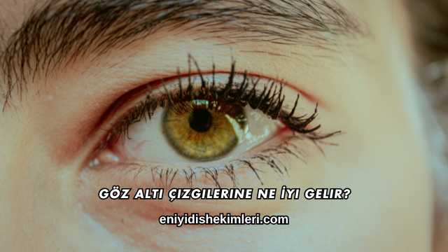 Göz Altı Çizgilerine Ne İyi Gelir?