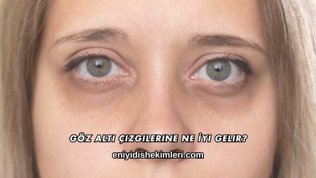 Göz Altı Çizgilerine Ne İyi Gelir?