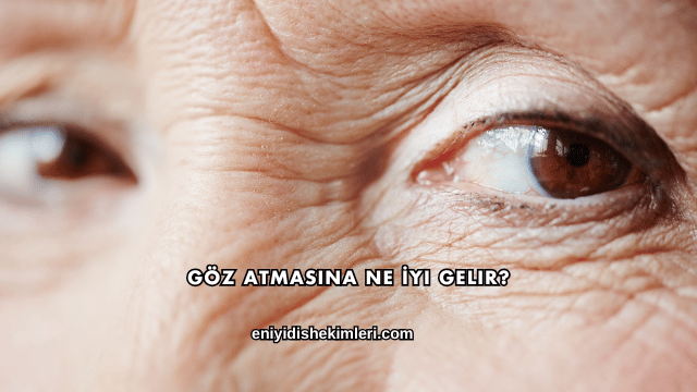 Göz Atmasına Ne İyi Gelir?