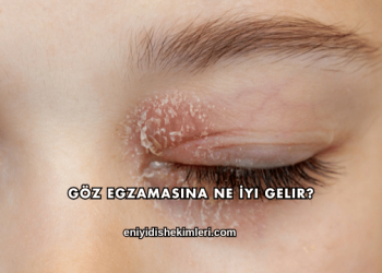 Göz Egzamasına Ne İyi Gelir?