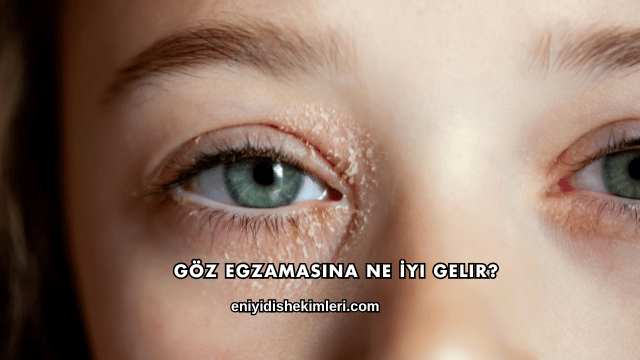 Göz Egzamasına Ne İyi Gelir?