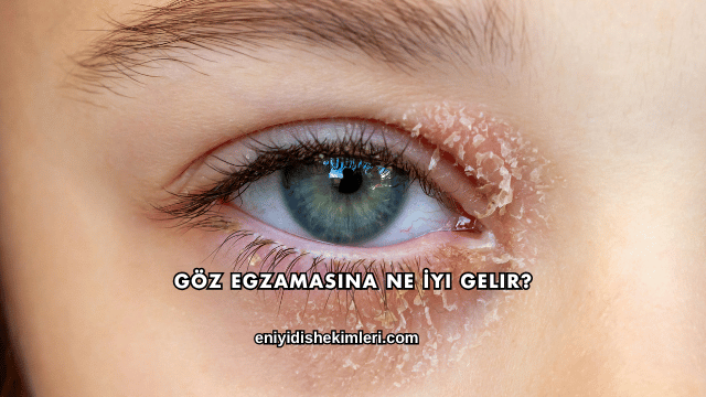 Göz Egzamasına Ne İyi Gelir?