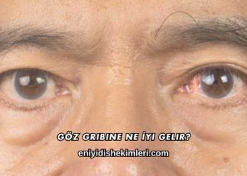Göz Gribine Ne İyi Gelir?