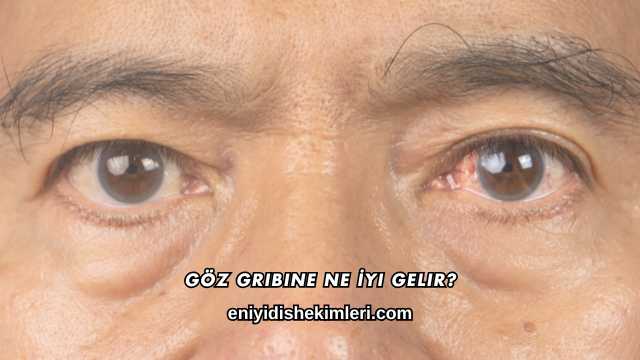 Göz Gribine Ne İyi Gelir?