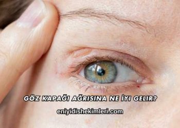 Göz Kapağı Ağrısına Ne İyi Gelir?