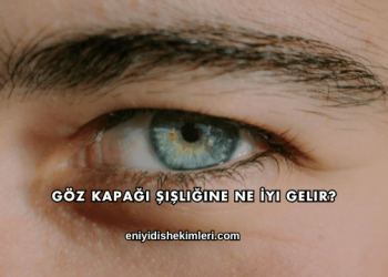 Göz Kapağı Şişliğine Ne İyi Gelir?