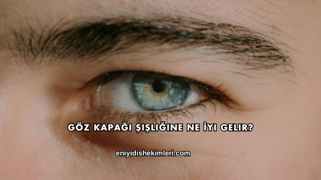 Göz Kapağı Şişliğine Ne İyi Gelir?