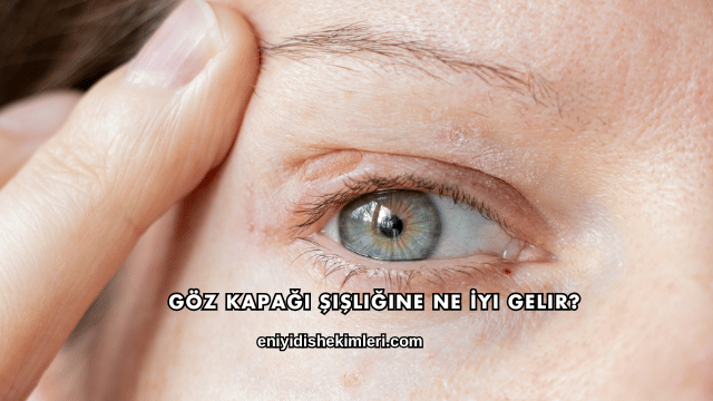 Göz Kapağı Şişliğine Ne İyi Gelir?