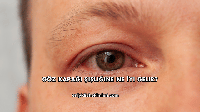 Göz Kapağı Şişliğine Ne İyi Gelir?