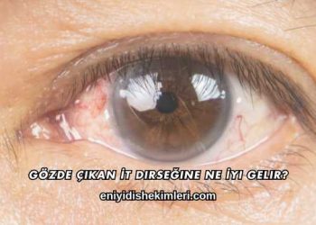 Gözde Çıkan İt Dirseğine Ne İyi Gelir?