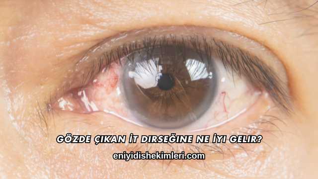 Gözde Çıkan İt Dirseğine Ne İyi Gelir?