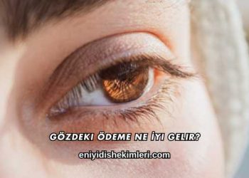 Gözdeki Ödeme Ne İyi Gelir?