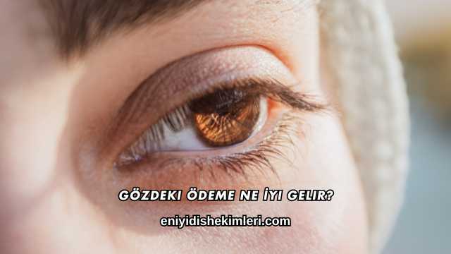 Gözdeki Ödeme Ne İyi Gelir?