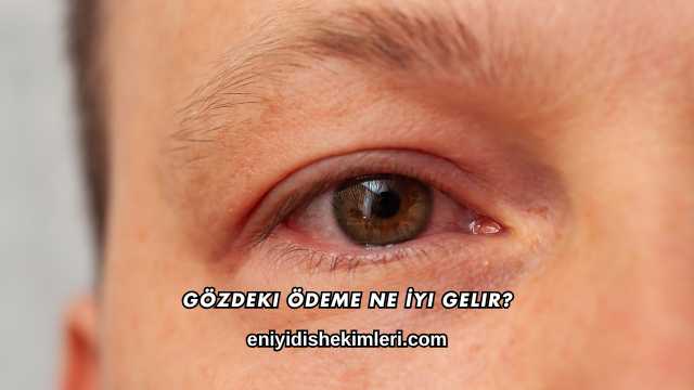 Gözdeki Ödeme Ne İyi Gelir?