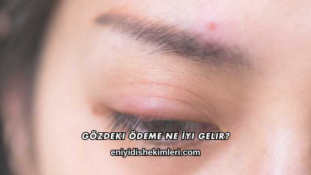 Gözdeki Ödeme Ne İyi Gelir?