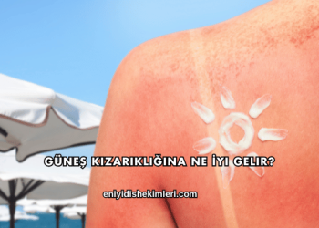 Güneş Kızarıklığına Ne İyi Gelir?
